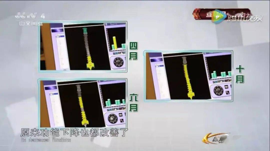 亚健康会胸痛吗_亚健康胸疼_胸椎亚健康的原因是