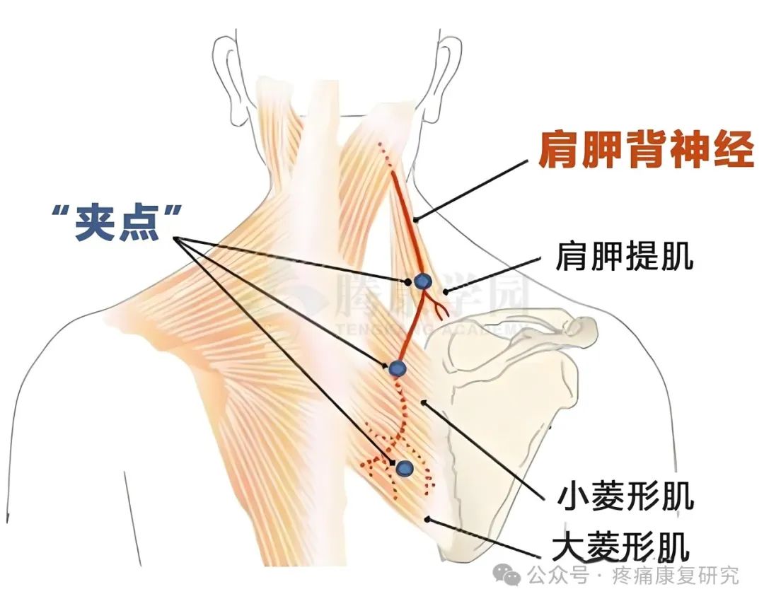 胸椎亚健康的原因是_胸部亚健康表现症状_胸椎的病