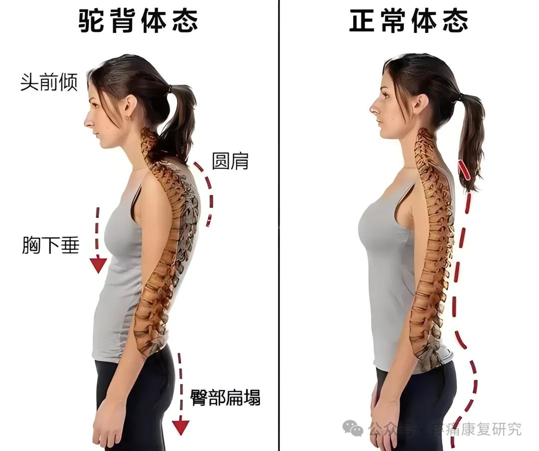 胸部亚健康表现症状_胸椎的病_胸椎亚健康的原因是